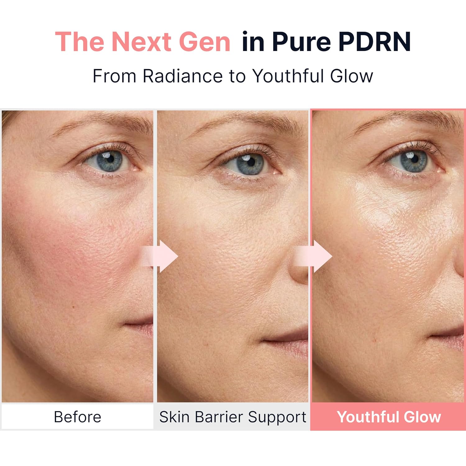 PDRN skin results