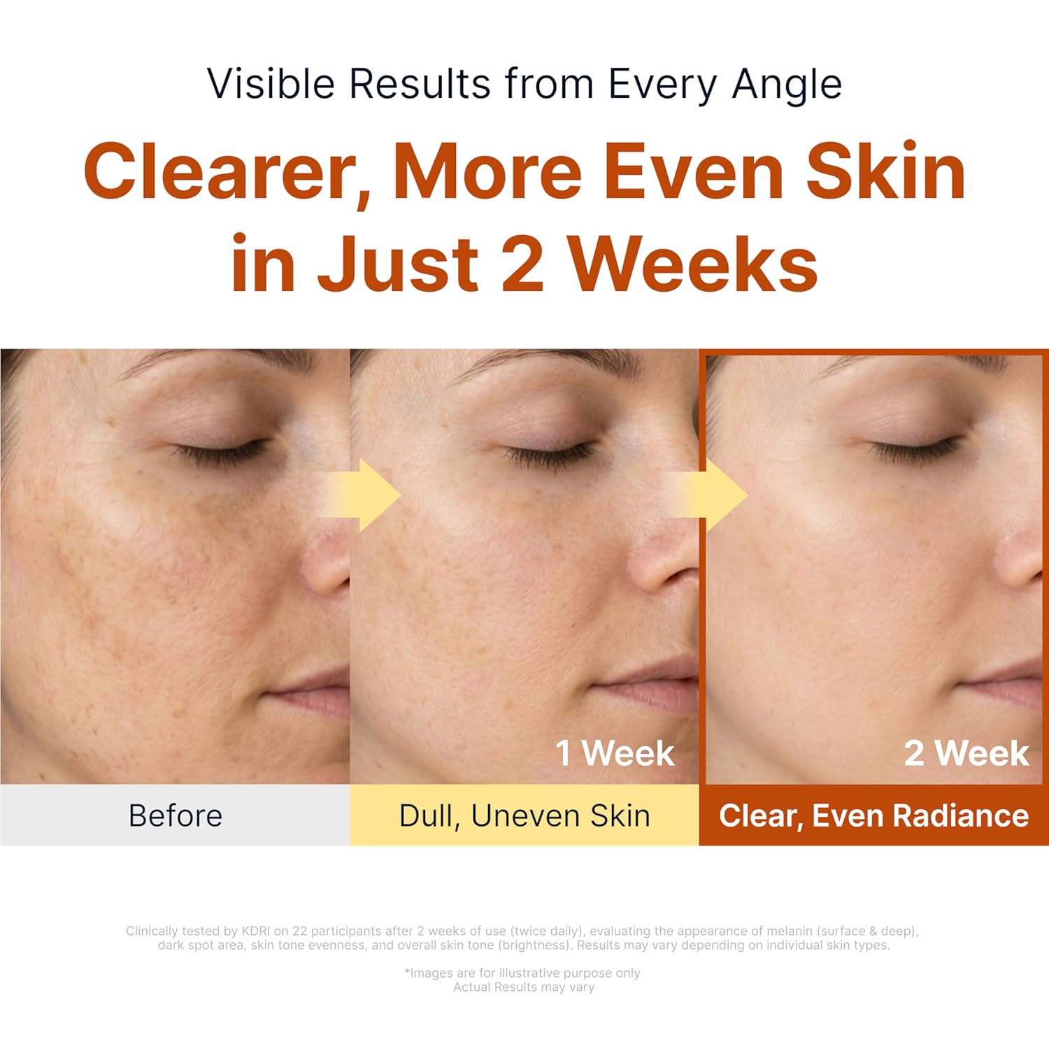Brightening results